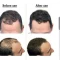 پودر پرپشت کننده موی سر 50 گرم Perfect pervis  تاپیک